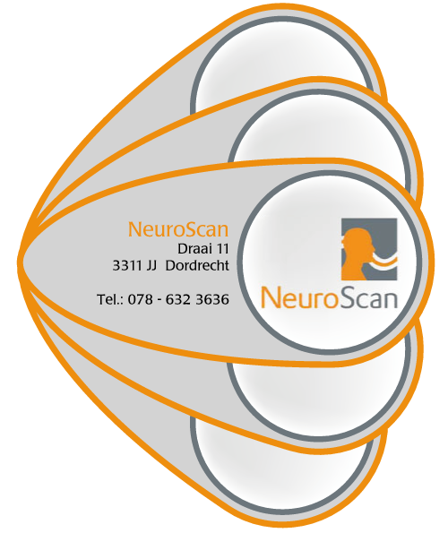 NeuroScan